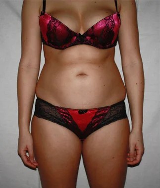 Antes de Ana Costa, 28 anos